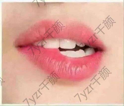 紋唇有哪些副作用呢？