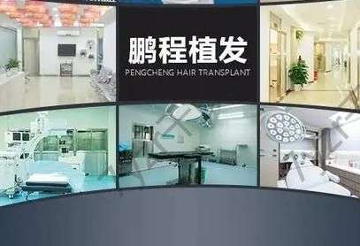 深圳調(diào)節(jié)脫發(fā)的正規(guī)醫(yī)院匯總單前六強(qiáng)收好了!個(gè)個(gè)手術(shù)技藝！