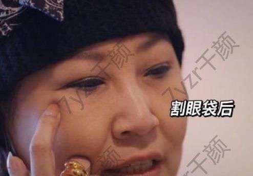 迪斯科女王之稱的張薔喊話整形醫(yī)生：下一單割眼袋要認(rèn)真負(fù)責(zé)