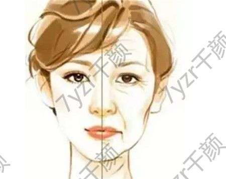 彩光嫩膚后皮膚干燥怎么辦，如何護(hù)理