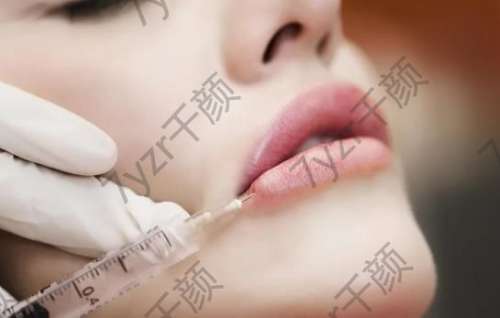 豐唇的方法有哪些?教你如何正確豐唇