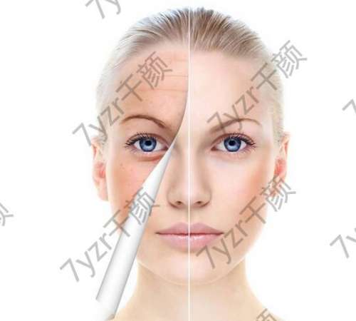 每個年齡段的女性應(yīng)該做哪些抗衰項目?