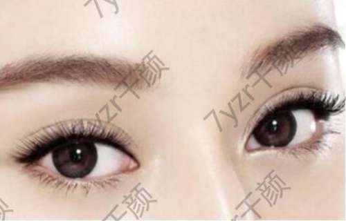 眼部整形常見類型及眼部手術(shù)后注意事項(xiàng)