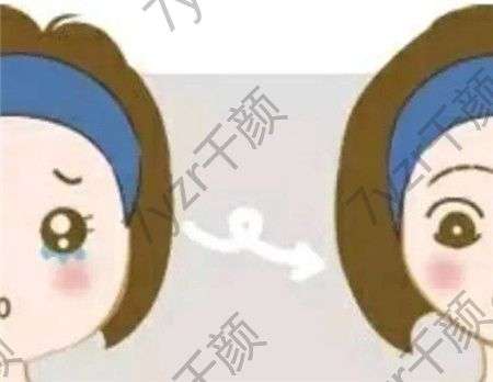 什么是溶脂針呢?溶脂針需要注射多少次