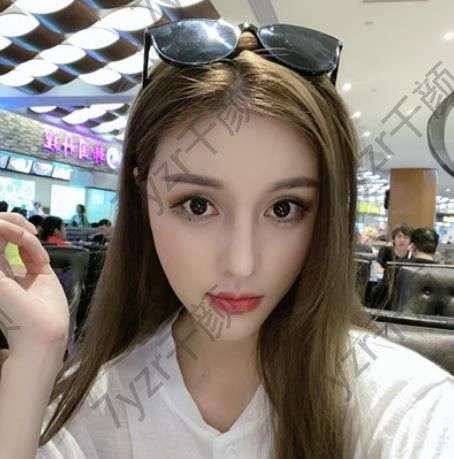 醫(yī)生雕刻的膨體材料特別符合自己