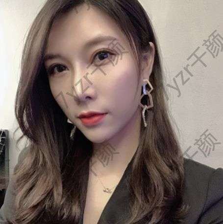 做隆鼻手術的醫(yī)院是我比較熟悉的醫(yī)院