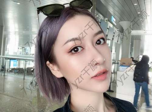 一直想擁有一個漂亮的鼻子終于在整形醫(yī)院實現(xiàn)了