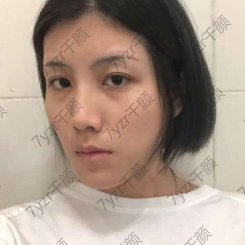 面部填完真的覺得年輕了十歲