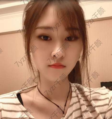 在埋線提升的第15天到現(xiàn)在為止感覺效果很好