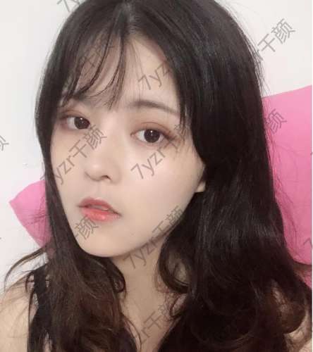 來做埋線提升因?yàn)槲矣X得我的臉頰兩邊都很寬