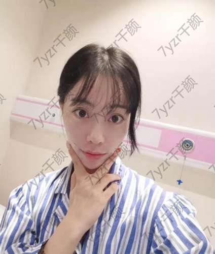 終于鼓起勇氣去做埋線的推廣