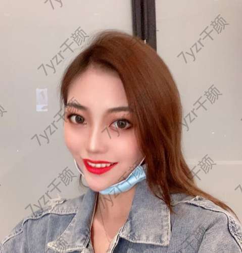 埋線提升已經(jīng)一個多月了，效果真的很好