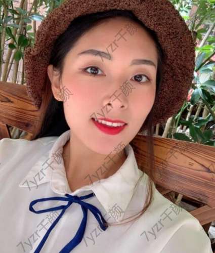 下垂的皮膚明顯的法令紋毛孔粗大都可以通過線雕來改良