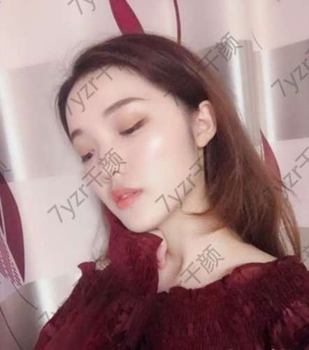 很多寶寶會擔心做線雕對年輕人不好