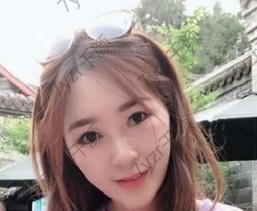 我的眼神多變有時(shí)候變成雙眼皮有時(shí)候變成單眼皮