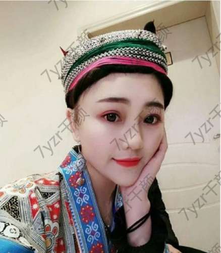 現(xiàn)在我的心理變化真的是隨著雙眼皮在變化