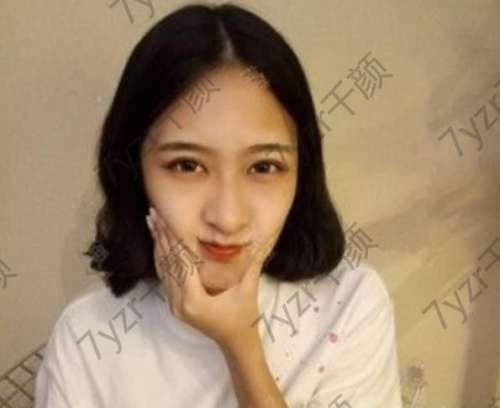 切開雙眼皮是未來長期效果好的