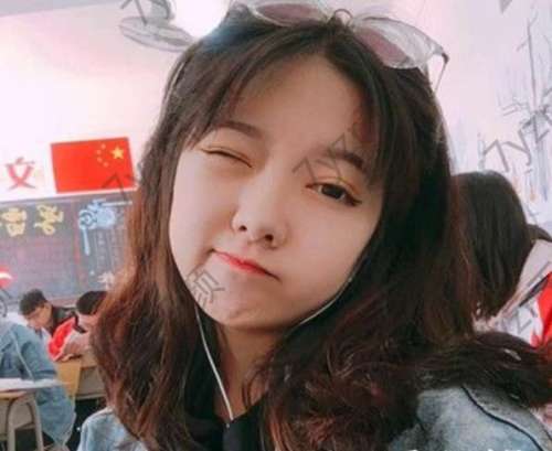 建議我做永久性雙眼皮