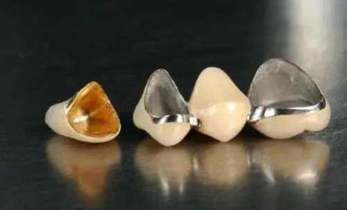 高效安全的牙齒美容方案：磨小裝烤瓷牙，讓您擁有自信燦爛的笑容！