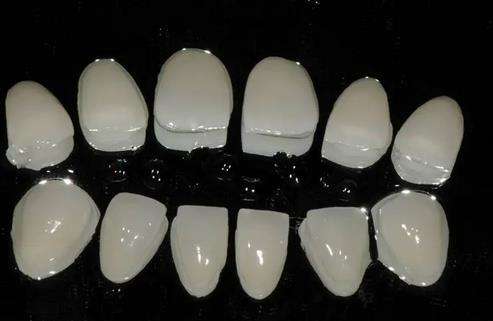 超強耐久！純鈦烤瓷牙讓您重拾自信笑容