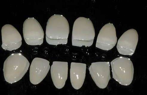 全瓷貼面?zhèn)溲缊D解，輕松掌握備牙技巧！