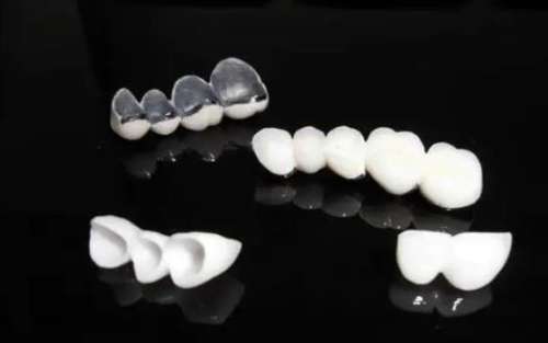 超值優(yōu)惠！純鈦烤瓷牙多少錢？讓您輕松擁有自信美牙！