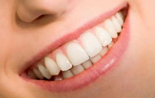 瓷貼面牙齒價格一覽，20顆牙齒多少錢？