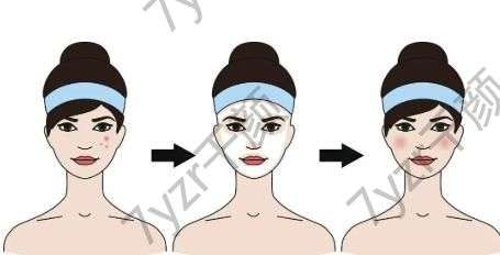 黑臉娃娃祛斑的原理，效果好嗎