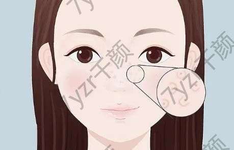 光子嫩膚需要做多少次才能看到效果