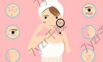 激光去紅血絲的原理是什么，有什么優(yōu)點(diǎn)