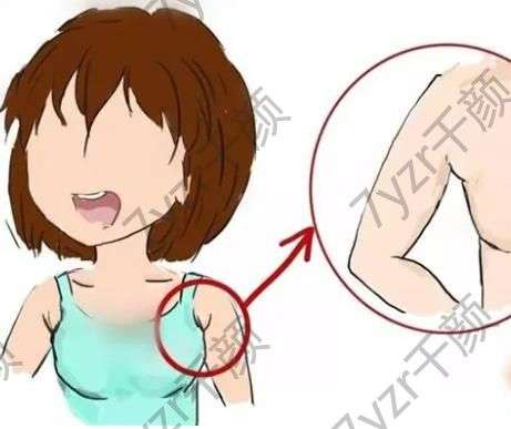 副乳切除術(shù)會影響身體嗎，副乳切除復(fù)雜嗎