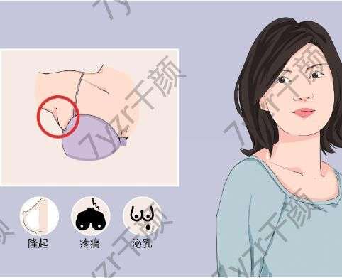 副乳切除后的注意事項有哪些，需要怎么護理