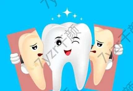 有哪些類型的烤瓷牙?