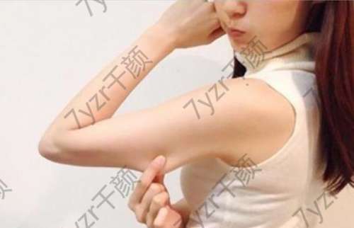 按摩解決上臂松弛水腫：簡單方法大效果