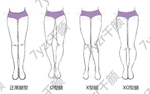 如何改良肌肉型小腿？——茜茜的減脂心得