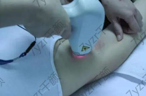 脫毛一般需要多少錢？脫毛去醫(yī)院還是美容院好？