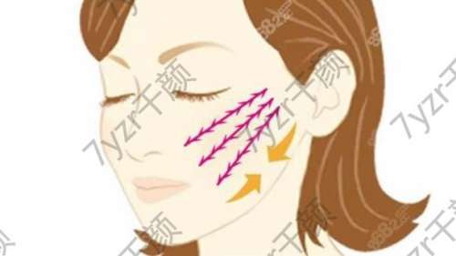 面部提升手術(shù)大概價格多少錢？匯總醫(yī)院口碑對比！