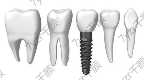 2024?？诜N牙價(jià)格表公布，鑲牙和種植牙區(qū)別解讀，附醫(yī)院推薦