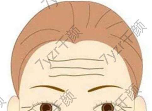 電波拉皮的效果如何？有什么作用？