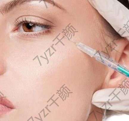 除皺針多久打一次好？了解注射頻率和效果持久性